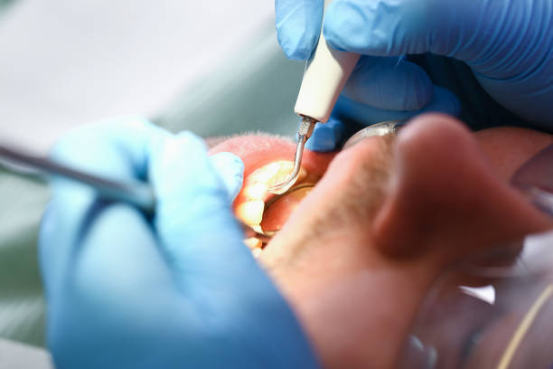 Best Emergency Dental Surgery in Fair Oaks, VA